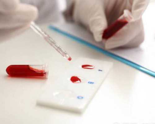 借卵包成功,多囊卵巢不来月经可以不管吗？会有什么危害？