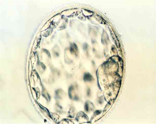去泰国做供卵试管要多少钱？到泰国做试管多少钱
