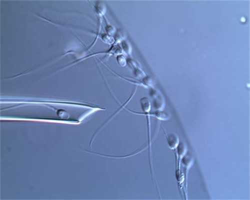 【城市】试管助孕：胚胎移植数量如何选择以确保安全与成功