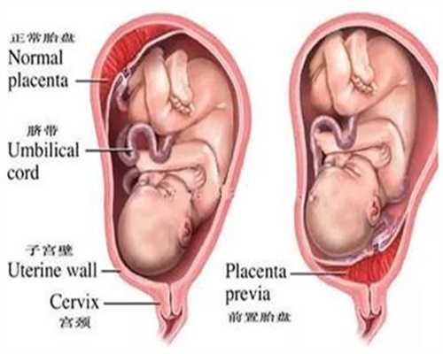 助孕 深圳：胎代孕宝宝的健康与代孕妈妈妈的状
