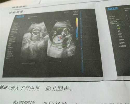 代孕的宝宝：怀二胎初期症状 与第一胎有什么不