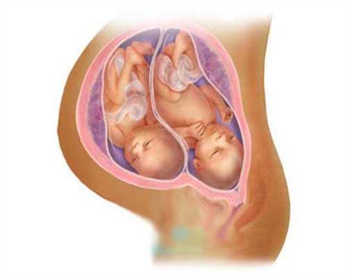 代孕1个月代孕一个月的症状注意事项