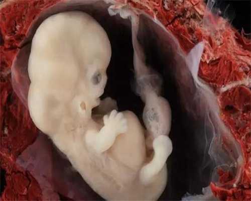 绍兴代孕双胞胎:不孕不育的症状和原因