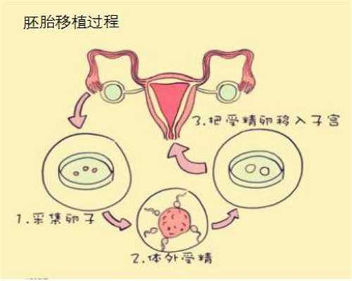 代孕怎么收费:治疗不孕不育的6大中药汤