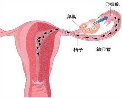 绍兴代孕知识:子宫内膜异位症吃什么药有效
