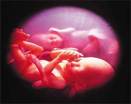 没有卵巢可以做代孕吗:输卵管造影会不会对身体