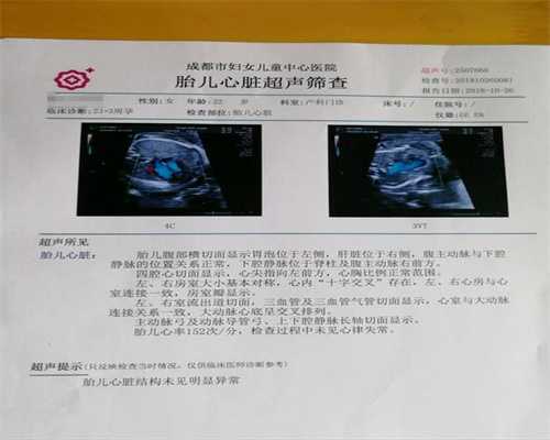 中国夫妇赴日找代孕:实施子宫纵隔手术的费用是
