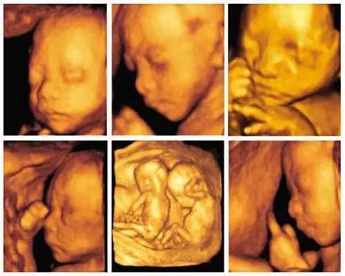 有人需要代生孩子吗:美国试管婴儿女性输卵管堵