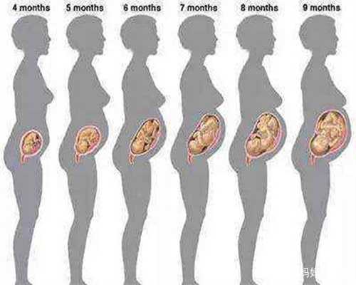 谁做代孕妈妈:哪些原因导致了宫颈肥大