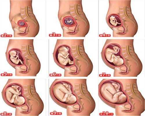 怎么找代生孩子的:宫颈性不孕的种类主要有哪几