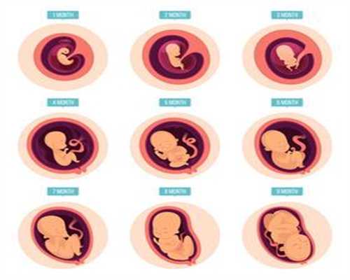 代孕产子的医院:介绍宫外孕会导致不孕不育吗